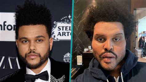 the weeknd face change